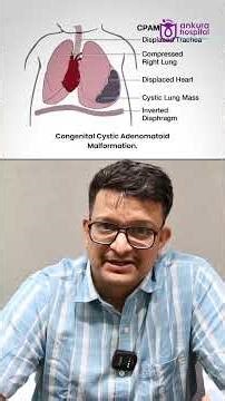 Advanced Chest Care for Children | VATS Explained by Dr. Abhijit Benare | Ankura Hospital