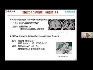 「血液検査からアルツハイマー病の兆候を検出する電気化学センサの開発」甲南大学 フロンティアサイエンス学部 生命化学科 教授 藤井 敏司