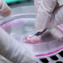 Video: Flow Cytometric Analysis of Lymphocyte Infiltration in Central Nervous System during Experimental Autoimmune Encephalomyelitis