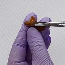 Video: Single-channel Analysis and Calcium Imaging in the Podocytes of the Freshly Isolated Glomeruli