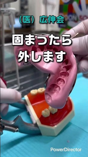 「歯」の模型ってどうやって作るの？ #歯医者#栄町歯科 #並木町歯科#希望が丘歯科