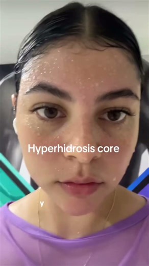 Sudoración EXCESIVA.#medicina #doctor #sabiasque #datoscurisos