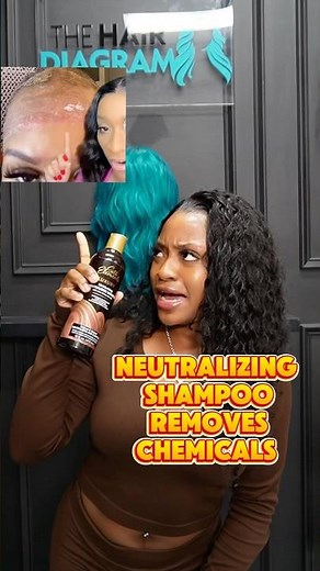 Prevent irritation! #burns #irritation #lacewigtutorial #boldholdactive #boldhold