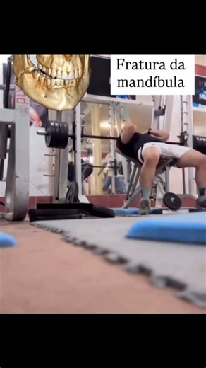 Me and Mylife on Instagram: "🔥 “Never Skip the Safety Lock – Your Workout Depends on It!” #GymSafety #UseSafetyLock #SafeLifting GymMistakes WorkoutSafety LiftSmart PreventInjury GymTips FitnessEducation SafetyFirst"