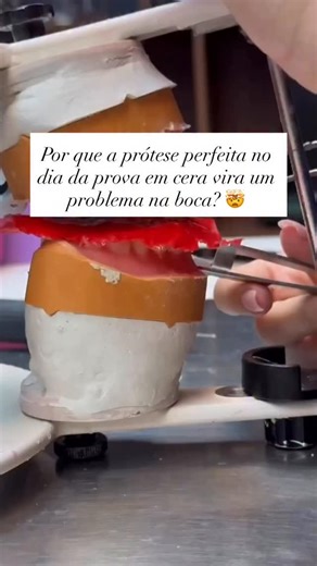 Prof. Lisiane Bannwart | Cursos Prótese Total on Instagram: "Você faz a prova. Os dentes estão lindos. DVO correta. Oclusão estável. A prótese volta do laboratório finalizada… E algo não encaixa mais. 👉 O que muita gente esquece (ou nunca aprendeu): A resina acrílica sofre contração de polimerização. E essa contração pode: • Alterar levemente a posição dos dentes (puxando eles para o centro) • Modificar a Dimensão Vertical de Oclusão (DVO) • Gerar contatos prematuros • Exigir ajustes oclusais i