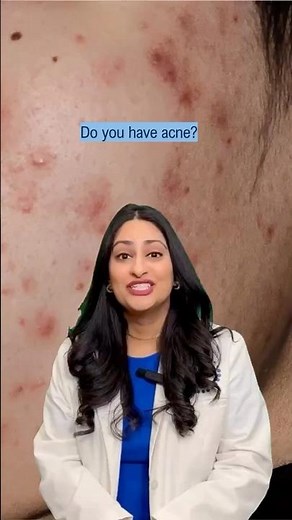 3 reasons to see a dermatologist for your acne