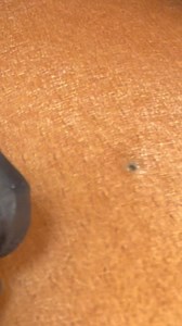 Jada Kennedy on Instagram: "Nothing Like Black Head On The Back."