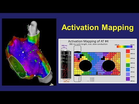 Activation Mapping: Basic Concepts, Pitfalls, and Windowing