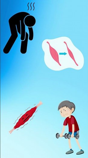 Lordosis Explained in 30 Seconds! #PhysioTips