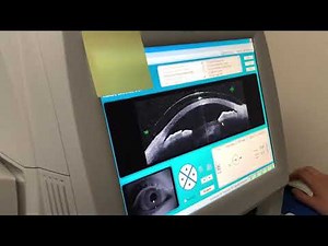How We Use Optical Coherence Tomography To Evaluate A Scleral Lens Fit