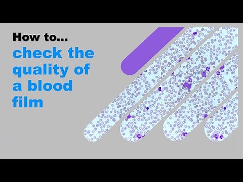 How to check the quality of a blood film