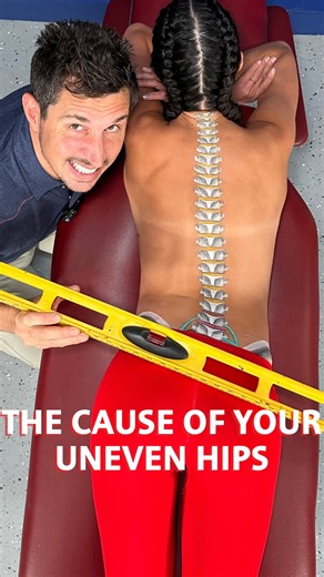 18K views · 116 reactions | Got uneven hips? That issue is stemming...