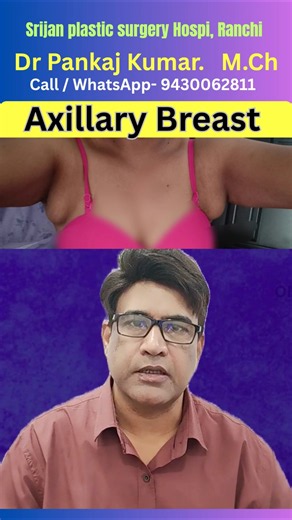 Axillary breast removal surgery in Ranchi| Axillary fat par removal on removal #shorts #axillary
