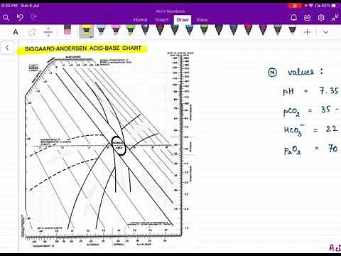 Interpretation of Siggard Anderson Nomograms Made easy ! Acid Base Balance Series. #abb #nephro #med