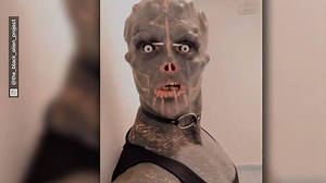 Franzose will Alien werden: Mann lässt sich freiwillig gesunde Gliedmaßen abschneiden