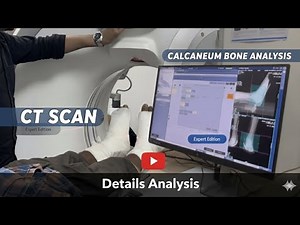 CT Scan of Calcaneum (Heel Bone) | Positioning & Procedure