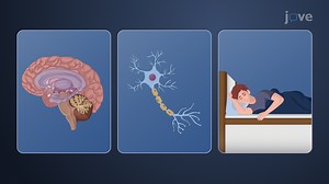 Video: Sedatives and Hypnotics: Overview