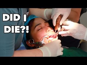 MY WISDOM TEETH EXTRACTION | Jessica Godinez