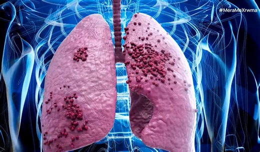 Το ιατρείο φυματίωσης της πνευμονολογικής κλινικής του νοσοκομείου Παπανικολάου - ertnews.gr