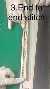 Peroneus longus graft preparation for ACL/ PCL arthroscopic reconstruction