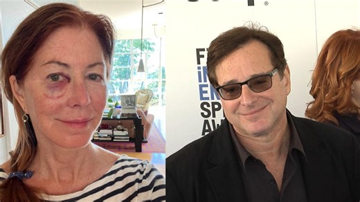 Bob Saget’s Death Prompted Actress to Go to Hospital After Fall