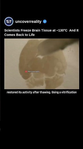 Scientists Freeze Brain Tissue At Minus 130°C & It Comes Back To Life #brain #shorts #tech