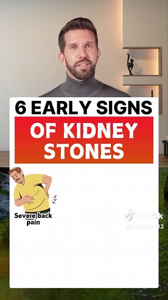 6 Early Signs of Kidney Stones You Should Know
