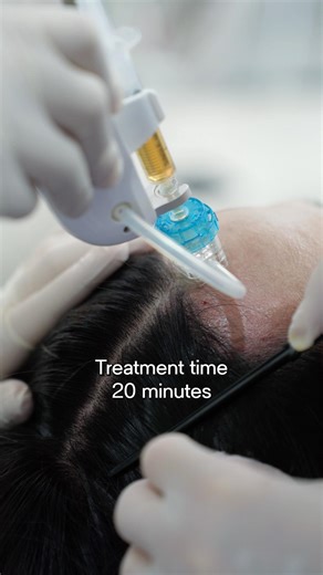 Exosome + Human Placenta Extract Scalp Booster👍