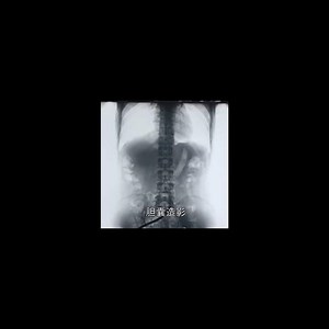 食道造影+胸部透视+胆囊造影 #fluoroscopy #xray #hospital #radiologypartners