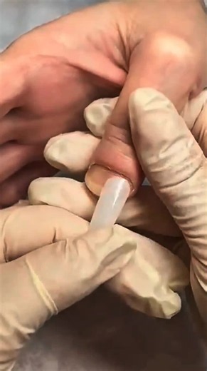 Dieser Daumen war so breit, dass kein einziger Tip gepasst hat. Also habe ich die Verlängerung komplett maßgefertigt – und das Ergebnis ist unglaublich. #Nageldesign #NailArt #NailTech #Nagelverlängerung #NailTransformation