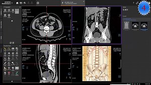 1.7K views · 46 reactions | 7 types of Non Contrast KUB Tracking | CT Scan and MRI study | Facebook