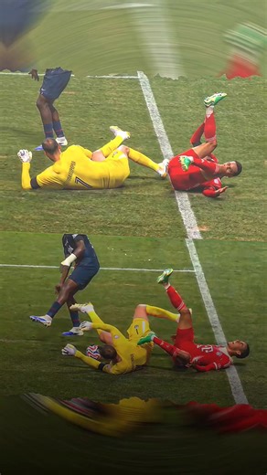 end of musiala's career,get well soon😢 . #musiala #jamal #fyp #cedera