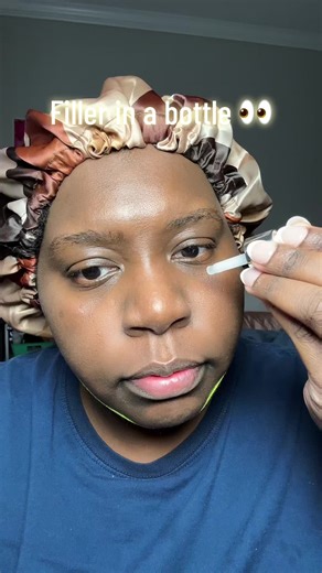 Volufiline: The Filler in a Bottle You've Been Looking For