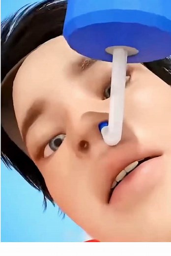 3D animation of the sinus irrigation process. #rhinitis #sinusiririum #foryou #sinusitis #tiktok