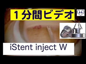 iStent inject W - 1 minute movie -