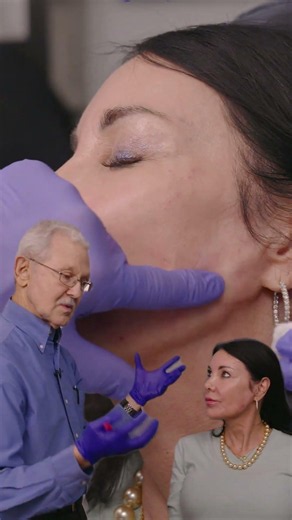 RADIESSE Treatments in Savannah, GA | Restore Volume and Boost Collagen Naturally