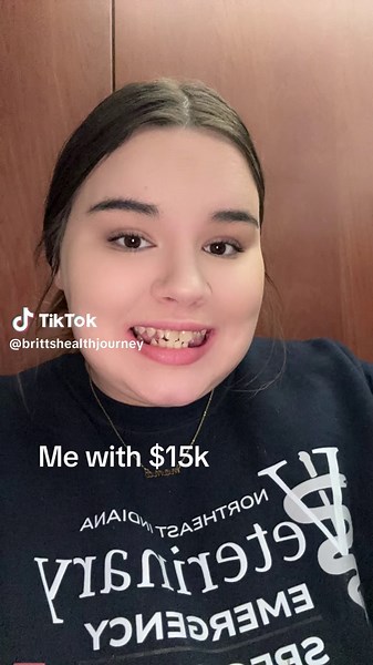 Transform Your Smile: $15K Dental Makeover Journey