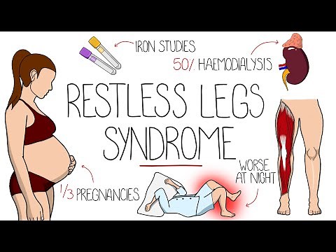 Restless Legs Syndrome Explained (Willis-Ekbom Disease)