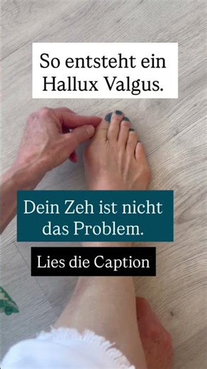 Wie ein Hallux valgus entsteht und wieso dein Zeh nicht das Problem ist.