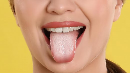 Dealing With Oral Thrush? Try These Home Remedies To Combat It