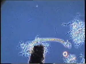 Motility of spiral-shaped bacteria