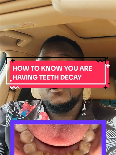 How to Detect Teeth Decay Early