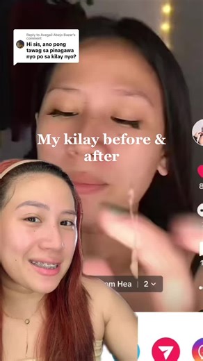 Transforming My Kilay Before & After Microblading Brows