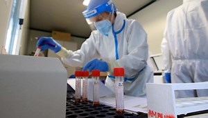 Variante Epsilon, 2 casi in Italia: è più resistente agli anticorpi