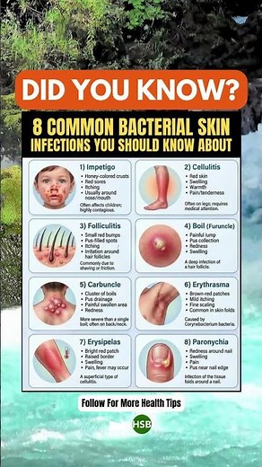 8 Skin Infections You Shouldn’t Ignore 🚨