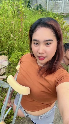 Understanding Amputation and Recovery Experiences