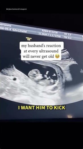 Dad’s bond with their children in those first 9 months too.🥹 (by: ‪@mommylabornurse‬ ) #life #dad