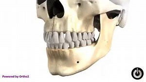 4.3K views · 15 reactions | Tooth eruption and growth of the Jaw പല്ലിന്റെയും താടിയെല്ലിന്റെയും വളർച്ച - വീഡിയോ കാണാം | Hair O Dent - FUE Hair Transplant - Kochi & Calicut | Facebook