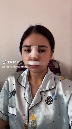 1 Year Transformation Journey | Stephanie Santiago Rhinoplasty