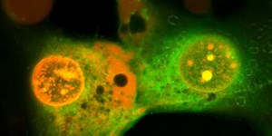 Nanomachines - Cancer Treatment - Aleteia